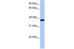 Image no. 1 for anti-Actin-Related Protein T2 (ACTRT2) (C-Term) antibody (ABIN630957)