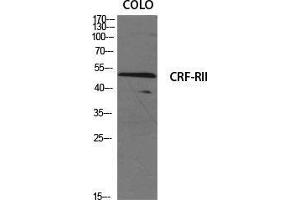 Image no. 2 for anti-Corticotropin Releasing Hormone Receptor 2 (CRHR2) (Internal Region) antibody (ABIN3180559)