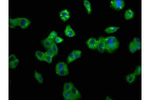Immunofluorescence staining of HepG2 cells with ABIN7173829 at 1:200, counter-stained with DAPI.