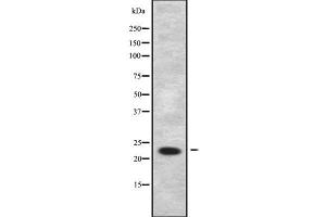 Image no. 1 for anti-Related RAS Viral (R-Ras) Oncogene Homolog 2 (RRAS2) (C-Term) antibody (ABIN6264865)