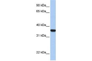Image no. 1 for anti-Homeobox D1 (HOXD1) antibody (ABIN2457968)