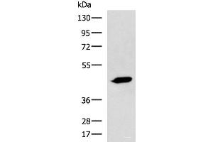 Western blot analysis of A431 cell lysate using ASB10 Polyclonal Antibody at dilution of 1:800