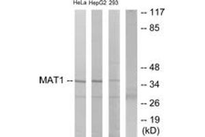 Image no. 1 for anti-Menage A Trois Homolog 1, Cyclin H Assembly Factor (Xenopus Laevis) (MNAT1) (AA 91-140) antibody (ABIN2889504)