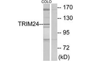 Image no. 2 for anti-Tripartite Motif Containing 24 (TRIM24) (AA 1001-1050) antibody (ABIN1533495)