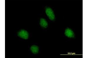 Immunofluorescence of purified MaxPab antibody to REPS1 on HeLa cell.