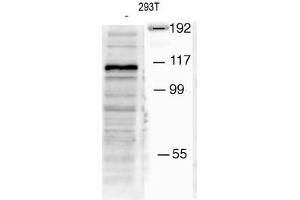 Image no. 1 for anti-Mindbomb E3 Ubiquitin Protein Ligase 1 (MIB1) (AA 13-42), (N-Term) antibody (ABIN388956)