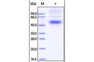 Image no. 1 for Interleukin 5 Receptor, alpha (IL5RA) (AA 21-335) protein (His tag) (ABIN2181392)