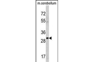 14-3-3 gamma anticorps  (AA 136-164)