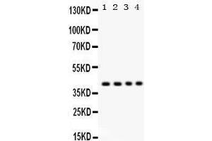 Image no. 2 for anti-Parvin, alpha (PARVA) (AA 155-185), (Middle Region) antibody (ABIN3043590)