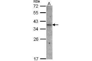 WB Image Sample(30 μg of whole cell lysate) A:Raji, 12% SDS PAGE antibody diluted at 1:1500