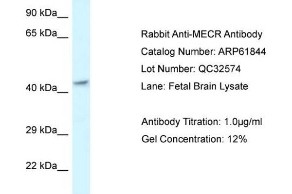 anti-Mitochondrial Trans-2-Enoyl-CoA Reductase (MECR) (C-Term) antibody