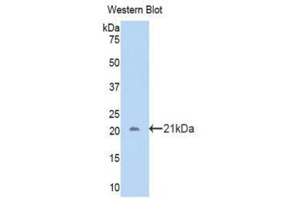 anti-Carbonic Anhydrase 12 (CA12) (AA 161-318) antibody