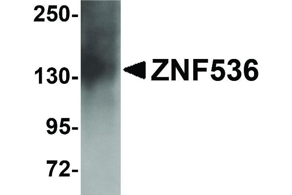 ZNF536 抗体  (N-Term)