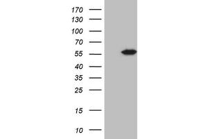 Image no. 3 for anti-4-Aminobutyrate Aminotransferase (ABAT) (AA 29-323) antibody (ABIN2715603)
