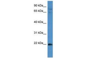 Image no. 1 for anti-Mitogen-Activated Protein Kinase Kinase Kinase 15 (MAP3K15) (AA 1201-1250) antibody (ABIN6743478)