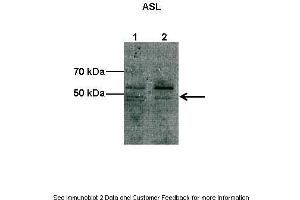 Image no. 1 for anti-Argininosuccinate Lyase (ASL) (C-Term) antibody (ABIN2774309)