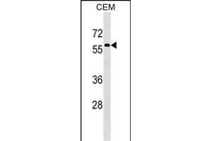 MSL3 antibody  (N-Term)