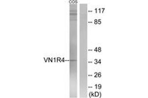 Image no. 2 for anti-Vomeronasal 1 Receptor 4 (VN1R4) (AA 88-137) antibody (ABIN1536019)