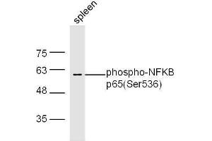 Image no. 4 for anti-Nuclear Factor-kB p65 (NFkBP65) (pSer536) antibody (ABIN730528)