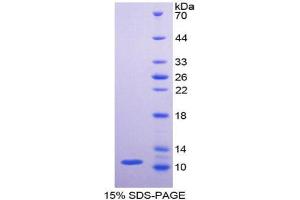 Image no. 1 for Pyruvate Kinase M1/2 (PKM) protein (ABIN3011415)