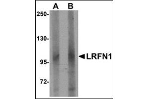 Image no. 2 for anti-Leucine Rich Repeat and Fibronectin Type III Domain Containing 1 (LRFN1) (C-Term) antibody (ABIN500186)