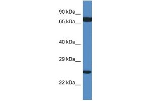 Image no. 2 for anti-Ribosomal Protein L7a (RPL7A) (C-Term) antibody (ABIN2788883)