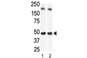 Image no. 1 for anti-Sphingosine Kinase 1 (SPHK1) (AA 1-30) antibody (ABIN3032709)