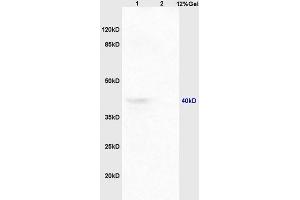 Image no. 1 for anti-Chemokine (C-C Motif) Receptor 9 (CCR9) (AA 65-160) antibody (ABIN734438)