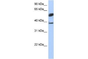 Image no. 1 for anti-Speckle-Type POZ Protein-Like (SPOPL) antibody (ABIN2459393)