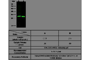 Image no. 1 for anti-Glutathione S-Transferase mu 2 (Muscle) (GSTM2) (AA 1-218) antibody (ABIN1999485)