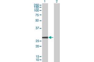 Image no. 2 for anti-Deoxythymidylate Kinase (Thymidylate Kinase) (DTYMK) (AA 1-212) antibody (ABIN515094)