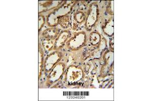 Immunohistochemistry (IHC) image for anti-DCP2 Decapping Enzyme Homolog (DCP2) antibody (ABIN2158497)