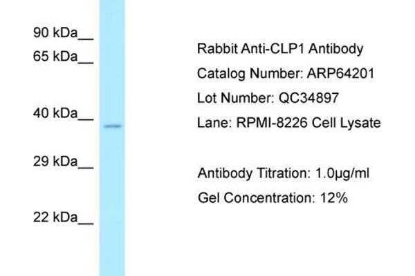 anti-Cleavage and Polyadenylation Factor I Subunit 1 (CLP1) (C-Term) antibody