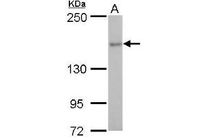Image no. 4 for anti-rho-Associated, Coiled-Coil Containing Protein Kinase 2 (ROCK2) (Center) antibody (ABIN2855440)