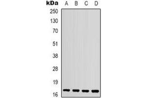 Image no. 2 for anti-Interleukin 1 Family, Member 10 (Theta) (IL1F10) (C-Term) antibody (ABIN2957638)