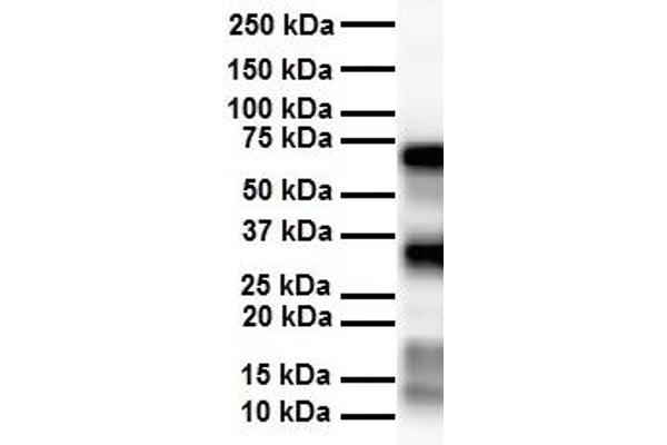 SLC25A12 antibody  (Middle Region)