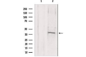 Image no. 2 for anti-Methionine Adenosyltransferase II, beta (MAT2B) (Internal Region) antibody (ABIN6263142)