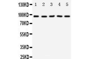 Image no. 4 for anti-Neurotrophic tyrosine Kinase, Receptor, Type 3 (NTRK3) (AA 172-186), (N-Term) antibody (ABIN3042961)