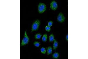 Image no. 1 for anti-Complement Factor H (CFH) (AA 751-780), (Middle Region) antibody (ABIN951646)