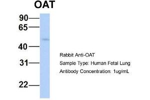 Image no. 4 for anti-Ornithine Aminotransferase (OAT) (Middle Region) antibody (ABIN2783233)