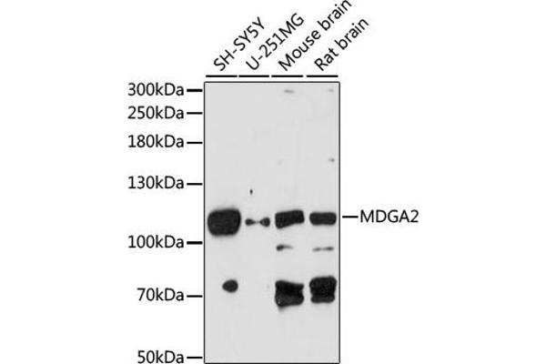 MDGA2 抗体  (AA 620-820)