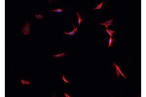 Image no. 1 for anti-Parkinson Protein 7 (PARK7) (C-Term) antibody (ABIN6264038)