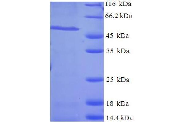 RALGPS1 Protein (AA 1-305) (His-SUMO Tag)