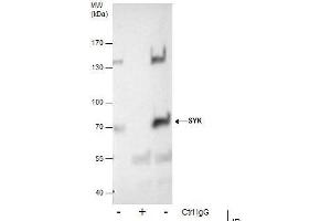 IP Image Immunoprecipitation of SYK protein from A431 whole cell extracts using 5 μg of SYK antibody [N2C2], Western blot analysis was performed using SYK antibody [N2C2], EasyBlot anti-Rabbit IgG  was used as a secondary reagent.