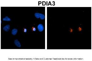 Image no. 2 for anti-Protein Disulfide Isomerase Family A, Member 3 (PDIA3) (C-Term) antibody (ABIN2774375)