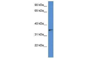 Image no. 1 for anti-Sorbitol Dehydrogenase (SORD) (N-Term) antibody (ABIN926669)