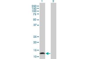 Image no. 2 for anti-Fatty Acid Binding Protein 1, Liver (FABP1) (AA 1-127) antibody (ABIN515480)