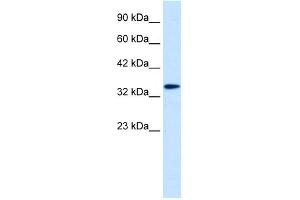 Image no. 1 for anti-Distal-Less Homeobox 6 (DLX6) (Middle Region) antibody (ABIN2776436)