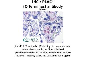 Image no. 1 for anti-Placenta-Specific 1 (PLAC1) (C-Term) antibody (ABIN1738141)