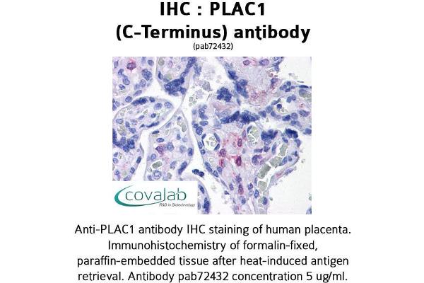 PLAC1 抗体  (C-Term)